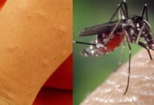 Photo of घर पर मच्छरों से छुटकारा पाने के 6 सबसे आसान और भरोसेमंद घरेलू उपाय