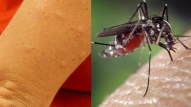 Photo of घर पर मच्छरों से छुटकारा पाने के 6 सबसे आसान और भरोसेमंद घरेलू उपाय